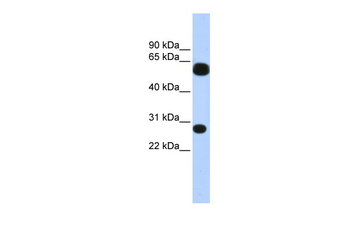 TRIM16 Rabbit Polyclonal Antibody