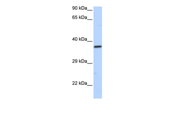 SCML1 Rabbit Polyclonal Antibody