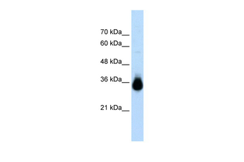 HOXC9 Rabbit Polyclonal Antibody