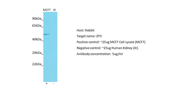 ZP3 Rabbit Polyclonal Antibody