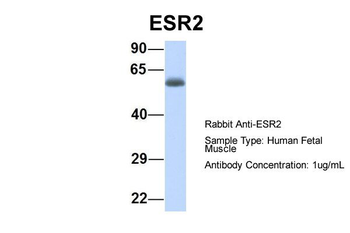 ESR2 Rabbit Polyclonal Antibody