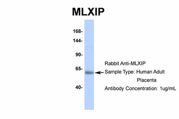 MLXIP Rabbit Polyclonal Antibody