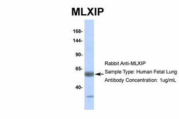MLXIP Rabbit Polyclonal Antibody