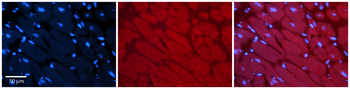 MLXIP Rabbit Polyclonal Antibody