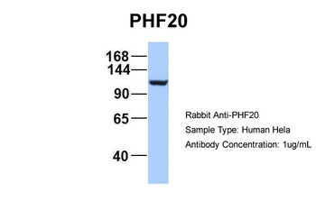 PHF20 Rabbit Polyclonal Antibody