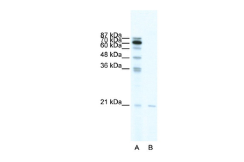 SCAND1 Rabbit Polyclonal Antibody