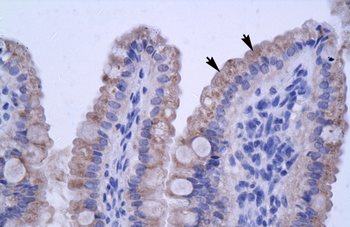 ZNF358 Rabbit Polyclonal Antibody