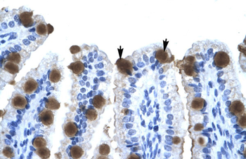 ZNF70 Rabbit Polyclonal Antibody