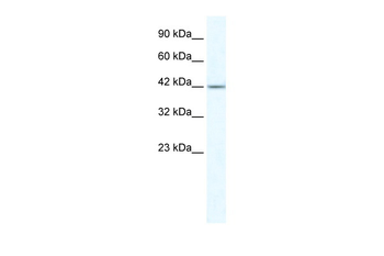 ZNF70 Rabbit Polyclonal Antibody