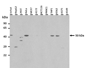 NR1I2 Rabbit Polyclonal Antibody