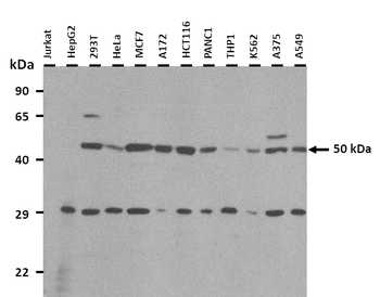 NR1I2 Rabbit Polyclonal Antibody