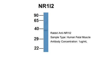 NR1I2 Rabbit Polyclonal Antibody