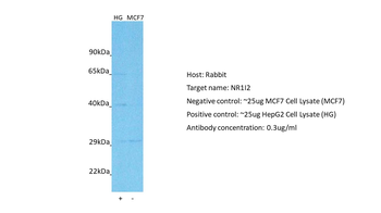 NR1I2 Rabbit Polyclonal Antibody