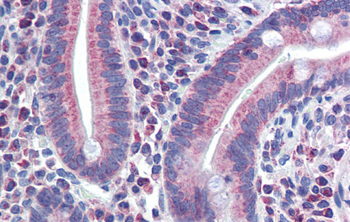 NR1I2 Rabbit Polyclonal Antibody