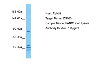 ZNF160 Rabbit Polyclonal Antibody