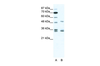 ZNF488 Rabbit Polyclonal Antibody