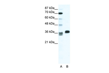 ESX1 Rabbit Polyclonal Antibody