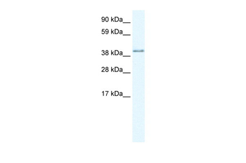 AKAP7 Rabbit Polyclonal Antibody