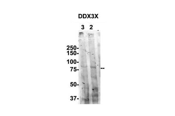 DDX3X Rabbit Polyclonal Antibody