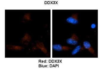 DDX3X Rabbit Polyclonal Antibody