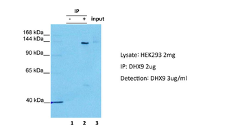 DHX9 Rabbit Polyclonal Antibody