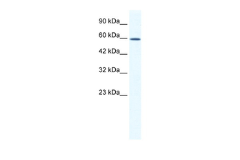 DDX5 Rabbit Polyclonal Antibody