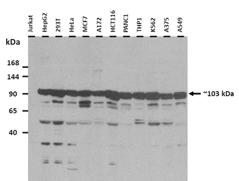 RAD54B Rabbit Polyclonal Antibody
