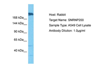 SNRNP200 Rabbit Polyclonal Antibody