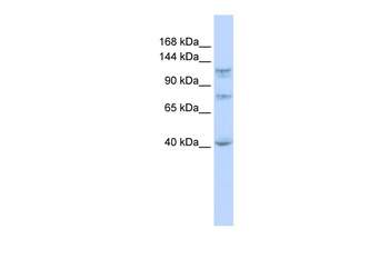 DHX30 Rabbit Polyclonal Antibody