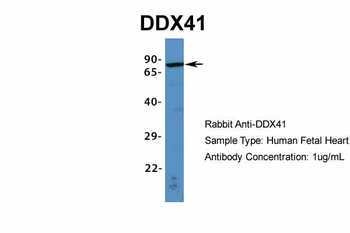 DDX41 Rabbit Polyclonal Antibody