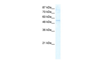 DDX19A Rabbit Polyclonal Antibody