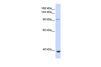 IFIH1 Rabbit Polyclonal Antibody
