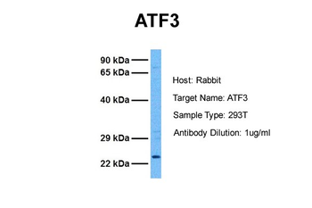 ATF3 Rabbit Polyclonal Antibody