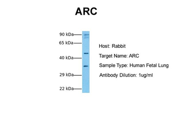 ARC Rabbit Polyclonal Antibody