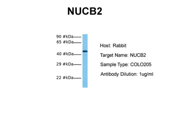 NUCB2 Rabbit Polyclonal Antibody