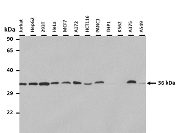 ANXA5 Rabbit Polyclonal Antibody