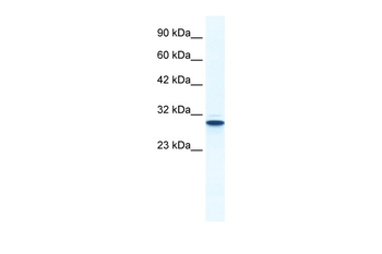 ANXA5 Rabbit Polyclonal Antibody
