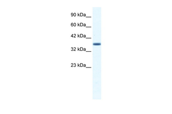 ANXA3 Rabbit Polyclonal Antibody