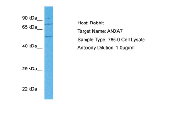 ANXA7 Rabbit Polyclonal Antibody
