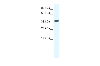 ANXA7 Rabbit Polyclonal Antibody