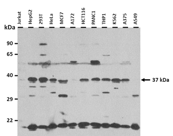 GJA4 Rabbit Polyclonal Antibody