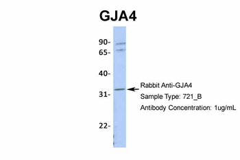 GJA4 Rabbit Polyclonal Antibody