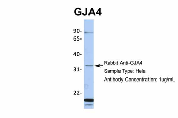 GJA4 Rabbit Polyclonal Antibody