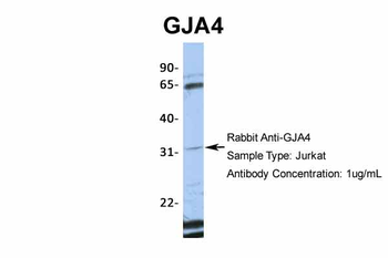 GJA4 Rabbit Polyclonal Antibody