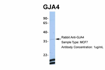 GJA4 Rabbit Polyclonal Antibody