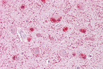 MCM3 Rabbit Polyclonal Antibody