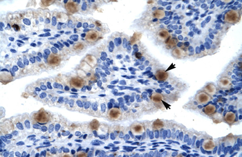 MCM6 Rabbit Polyclonal Antibody