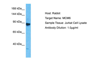 MCM6 Rabbit Polyclonal Antibody