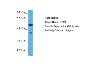 SPP1 Rabbit Polyclonal Antibody