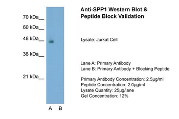 SPP1 Rabbit Polyclonal Antibody